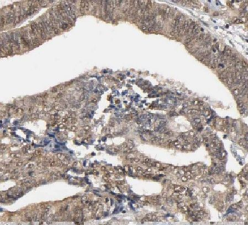 LCOR Rabbit Polyclonal Antibody