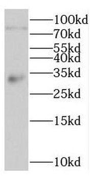 LDB3 Rabbit Polyclonal Antibody