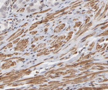 LDB3 Rabbit Polyclonal Antibody
