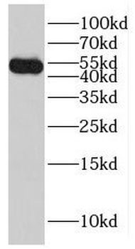 LDHD Antibody