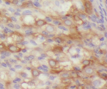 LENG1 Rabbit Polyclonal Antibody
