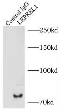 P3H2 Rabbit Polyclonal Antibody