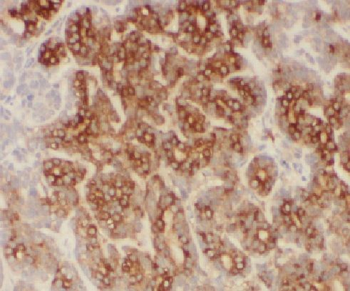 P3H2 Rabbit Polyclonal Antibody