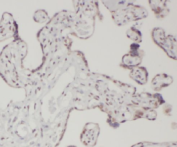 LETM2 Antibody