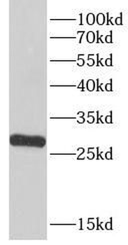 LHPP Antibody