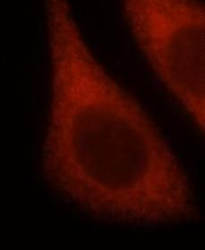 LHPP Rabbit Polyclonal Antibody