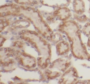 LHPP Rabbit Polyclonal Antibody
