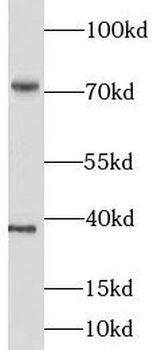 LIMK1 Rabbit Polyclonal Antibody