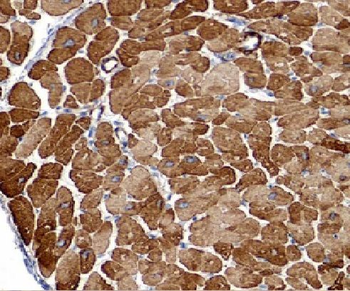 LIMK1 Rabbit Polyclonal Antibody