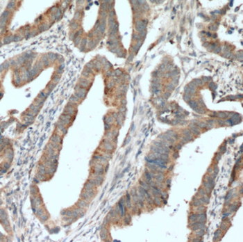 LIPA Rabbit Polyclonal Antibody