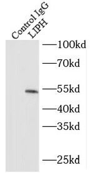 LIPH Rabbit Polyclonal Antibody