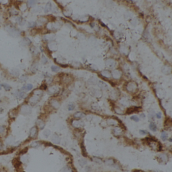 LMF2 Rabbit Polyclonal Antibody