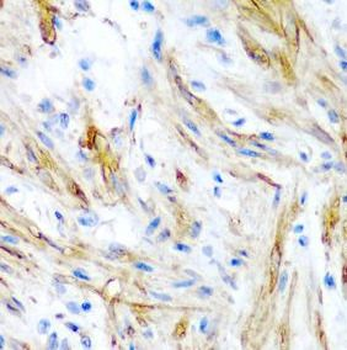 LMOD1 Antibody