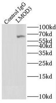 LMOD3 Rabbit Polyclonal Antibody