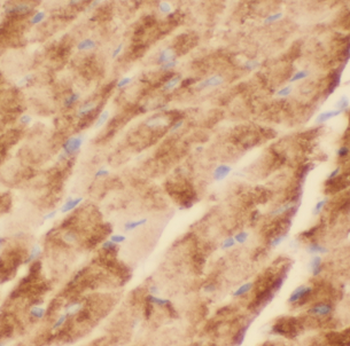 LMOD3 Rabbit Polyclonal Antibody