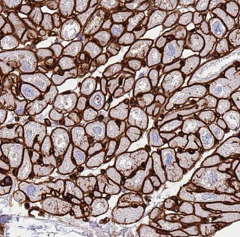 LNPEP Rabbit Polyclonal Antibody