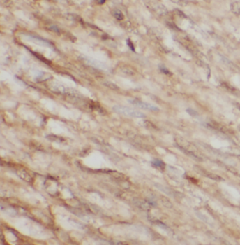 LOX Rabbit Polyclonal Antibody