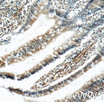 LPP Rabbit Polyclonal Antibody
