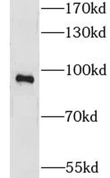 LRCH1 Antibody