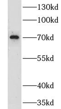 LRCH3 Antibody