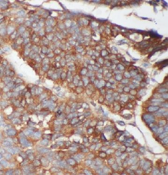LRP5 Antibody
