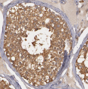 LRRC41 Rabbit Polyclonal Antibody