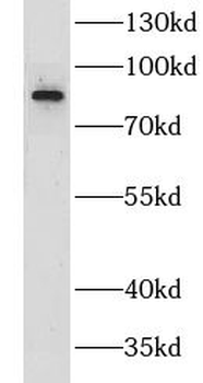 LRWD1 Antibody