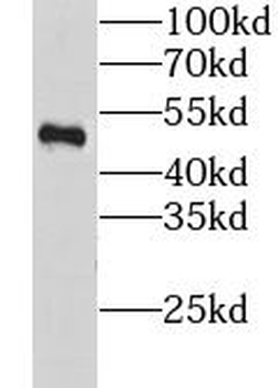 LSM11 Antibody