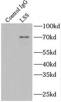 LSS Rabbit Polyclonal Antibody