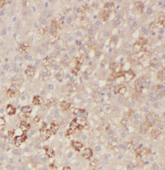 LSS Rabbit Polyclonal Antibody