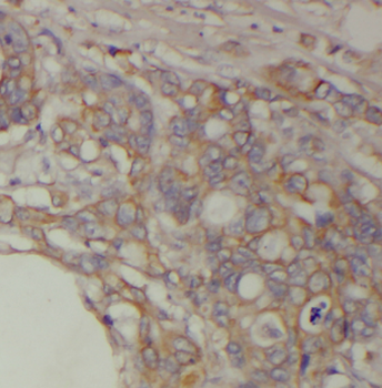 LY6G5B Antibody