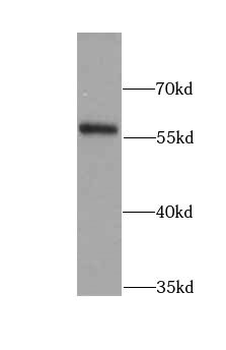 LYN Rabbit Polyclonal Antibody