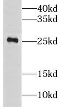 LYPLA1 Rabbit Polyclonal Antibody