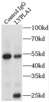LYPLA1 Rabbit Polyclonal Antibody