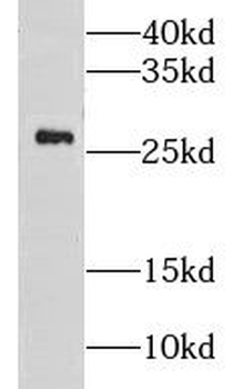 LYPLAL1 Rabbit Polyclonal Antibody