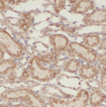 LYPLAL1 Rabbit Polyclonal Antibody