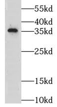 LZTFL1 Antibody