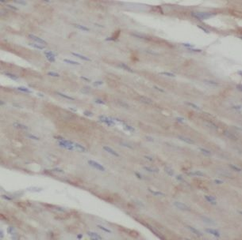 LZTFL1 Rabbit Polyclonal Antibody
