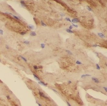 MACF1 Antibody