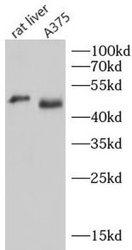 MAGEA4 Antibody
