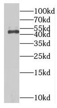 MAGEA8 Antibody