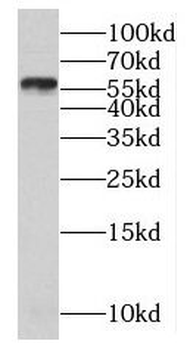 MAGEB18 Rabbit Polyclonal Antibody