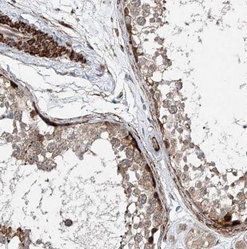 MAGEB18 Rabbit Polyclonal Antibody