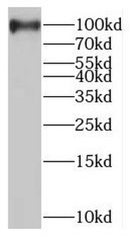 MAGED1 Antibody