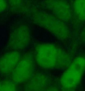 MAK16 Rabbit Polyclonal Antibody