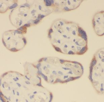 MAN1A2 Rabbit Polyclonal Antibody