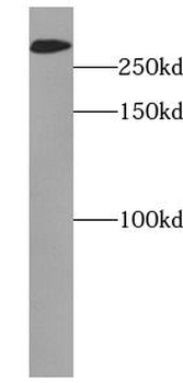 MAP1B Rabbit Polyclonal Antibody