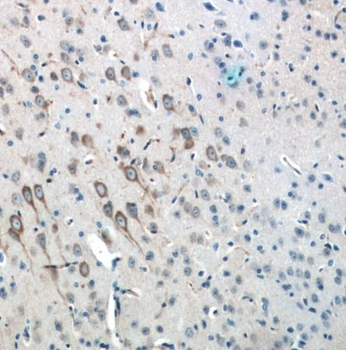 MAP1B Rabbit Polyclonal Antibody