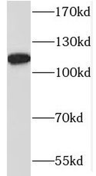 MAP1S Antibody