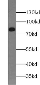 MAP2 Rabbit Polyclonal Antibody